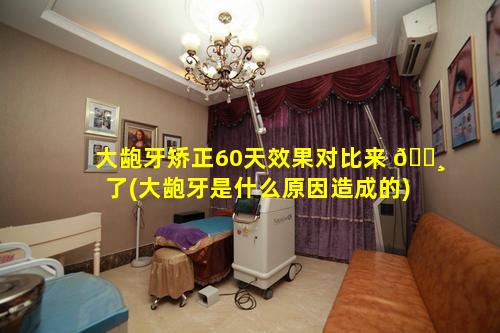 大龅牙矫正60天效果对比来 🌸 了(大龅牙是什么原因造成的)